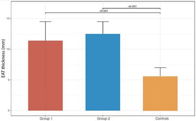 Imbalance Between Interleukin-1β and Interleukin-1 Receptor Antagonist in Epicardial Adipose Tissue Is Associated With Non ST-Segment Elevation Acute Coronary Syndrome